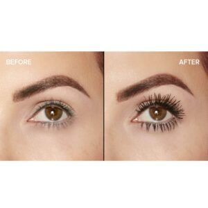 Before-and-after close-up of a woman's eyebrow area showing improved skin texture after treatment (left: before, right: after).